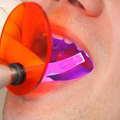 Dental curing light in mouth